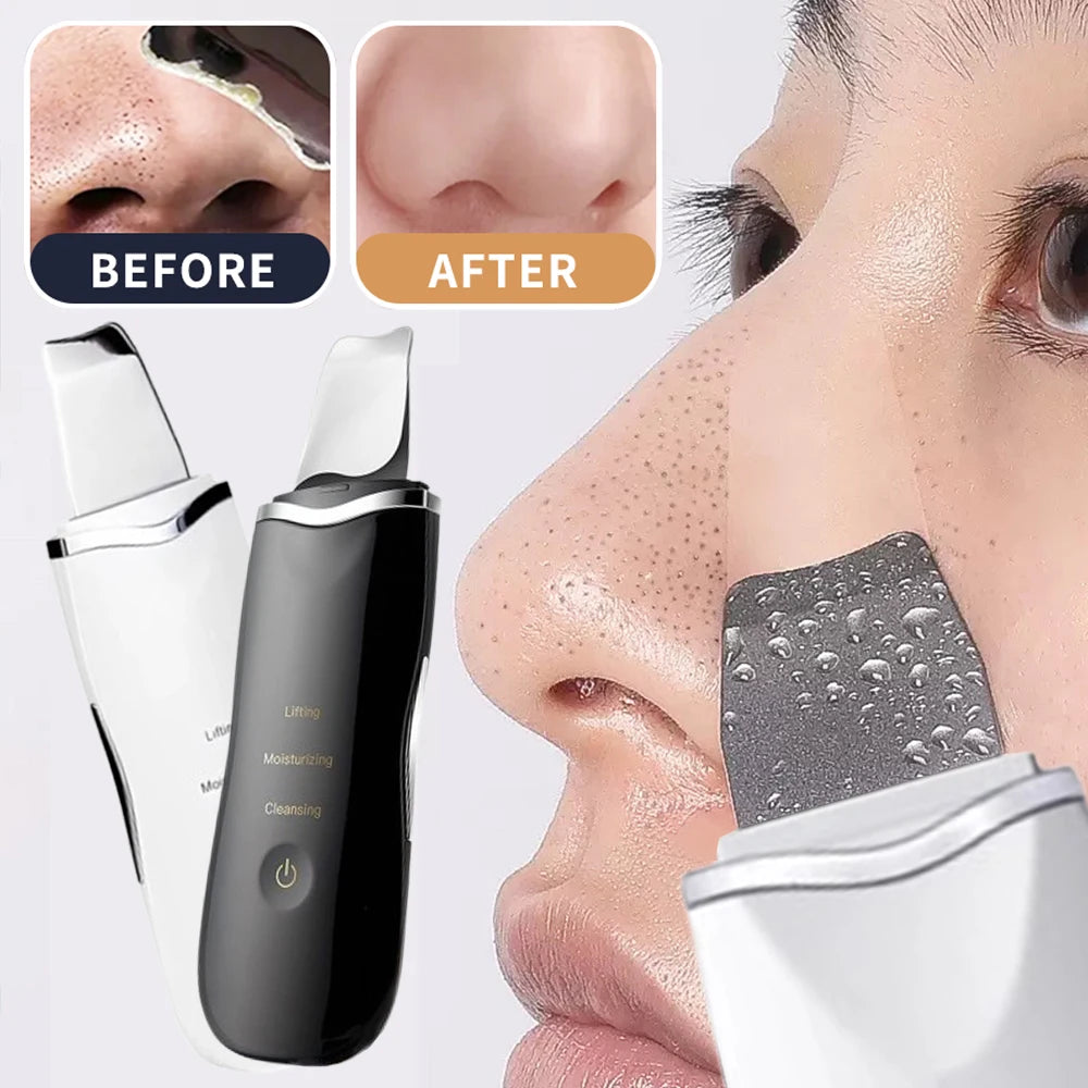 Electric Skin Scrubber Peeling Blackhead Remover