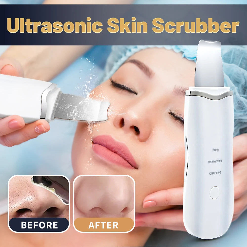 Ultrasonic Skin Scrubber Ance Pore Cleaner
