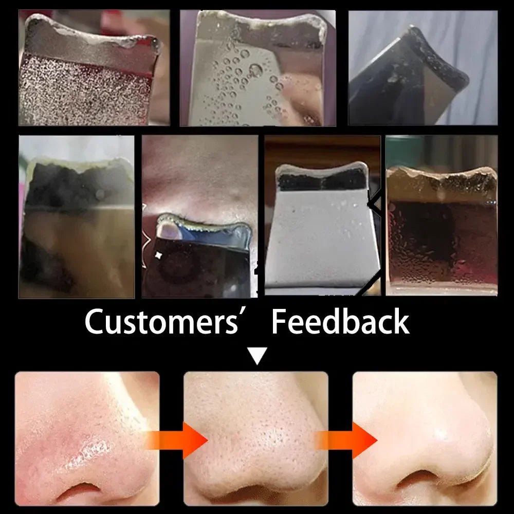 Electric Skin Scrubber Peeling Blackhead Remover